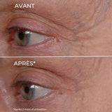 White Tea Eye Contour